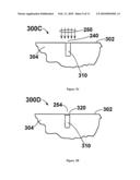 MEDICAL DEVICE FOR BONE IMPLANT AND METHOD FOR PRODUCING SUCH DEVICE diagram and image