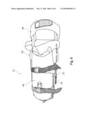 PROSTHETIC DEVICE diagram and image