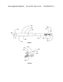 Side mounted drill bolt and threaded anchor system for veneer wall tie connection diagram and image