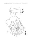 Gantry for Medical Particle Therapy Facility diagram and image