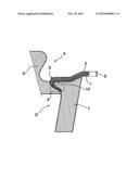 INJECTION MOLD FOR THE PRODUCTION OF AN INJECTION-MOLDED PART FROM A RIGID PLASTIC LAYER AND A PLASTIC FOAM SURFACE LAYER diagram and image