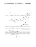 SEISMIC DATA ACQUISITION ASSEMBLY diagram and image