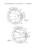 SWEPT ANNODE CT SCANNER diagram and image