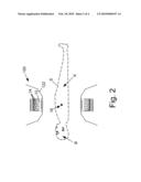 LARGE BORE PET AND HYBRID PET/CT SCANNERS AND RADIATION THERAPY PLANNING USING SAME diagram and image