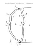 Embossed Drawtape for Polymeric Bags diagram and image