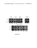 Digalactolipidic Antigen Exposed on the Surface of Apicomplex Parasites, and Diagnostic and Therapeutic Use Thereof diagram and image