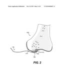 Tissue Scaffolds diagram and image