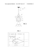 Protocol For Risk Stratification of Ischemic Events and Optimized Individualized Treatment diagram and image