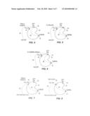 Protocol For Risk Stratification of Ischemic Events and Optimized Individualized Treatment diagram and image