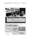 MICROFLUIDIC EMBEDDED POLYMER NEMS FORCE SENSORS diagram and image