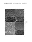 EXPANSION OF DEFINITIVE ENDODERM CELLS diagram and image