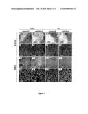 Use of Aplidine for the Treatment of Pancreatic Cancer diagram and image