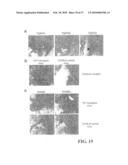 Amelioration of Inflammatory Arthritis By Targeting the Pre-ligand Assembly Domain (Plad) of Tumor Necrosis Factor Receptors diagram and image