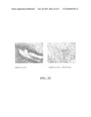 Amelioration of Inflammatory Arthritis By Targeting the Pre-ligand Assembly Domain (Plad) of Tumor Necrosis Factor Receptors diagram and image