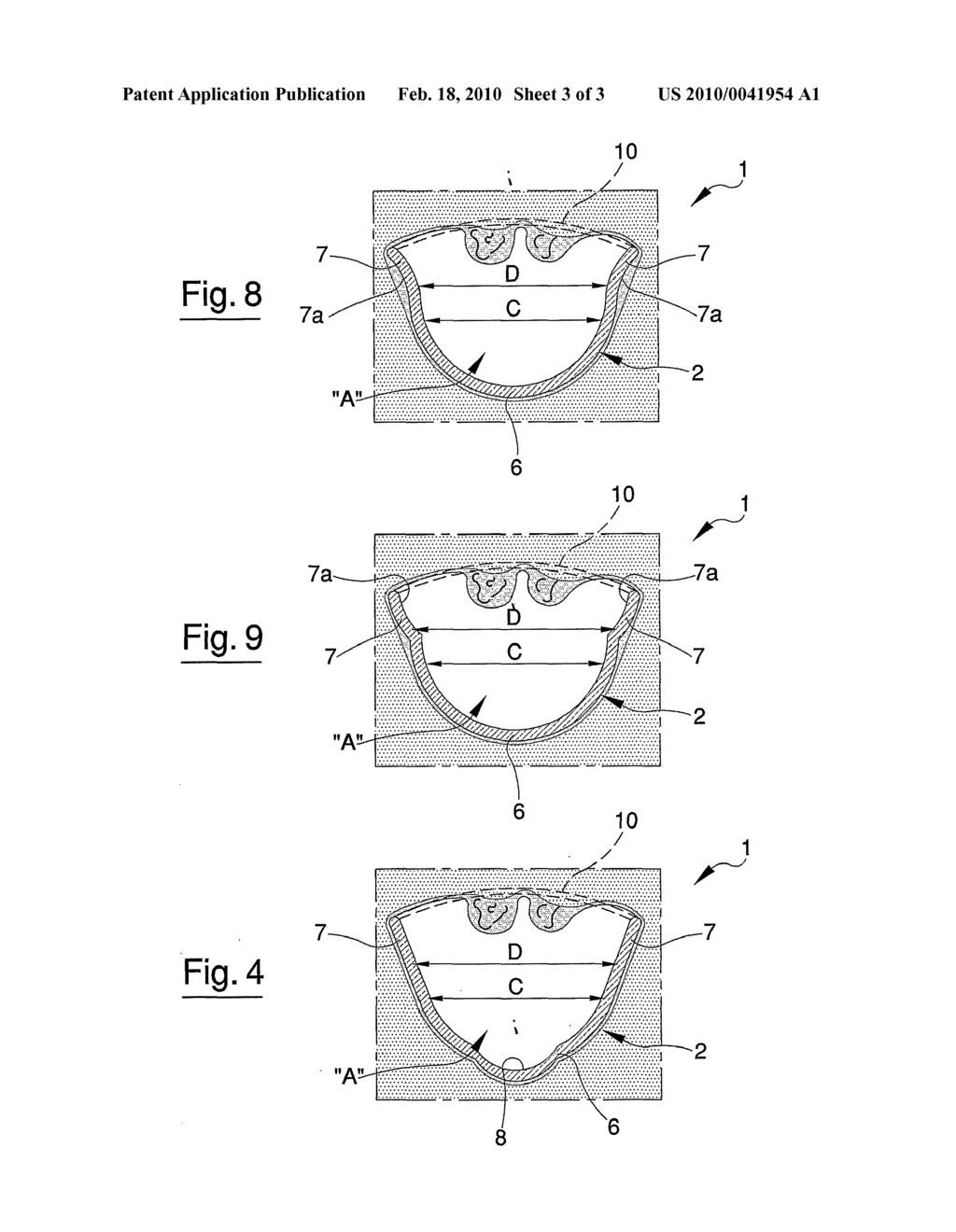 DEVICE FOR EXAMINING AND SURGICALLY OPERATING ON BODY CAVITIES, IN PARTICULAR THE ANAL AND VAGINAL CAVITIES - diagram, schematic, and image 04