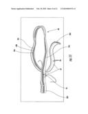 Physiological monitoring garment diagram and image