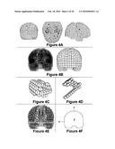 Three-dimensional localization, display, recording, and analysis of electrical activity in the cerebral cortex diagram and image