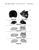 Three-dimensional localization, display, recording, and analysis of electrical activity in the cerebral cortex diagram and image