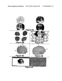 Three-dimensional localization, display, recording, and analysis of electrical activity in the cerebral cortex diagram and image