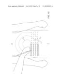 APPARATUS AND METHODS FOR THE DESTRUCTION OF ADIPOSE TISSUE diagram and image