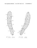 Segmented pneumatic pad regulating pressure upon parts of the body during usage diagram and image