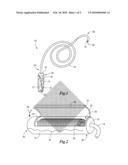 STERILE APPLIANCE DELIVERY DEVICE FOR ENDOSCOPIC PROCEDURES diagram and image