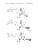 STERILE APPLIANCE DELIVERY DEVICE FOR ENDOSCOPIC PROCEDURES diagram and image