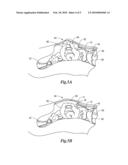 STERILE APPLIANCE DELIVERY DEVICE FOR ENDOSCOPIC PROCEDURES diagram and image