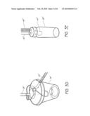 AUXILIARY POWERED NEGATIVE PRESSURE WOUND THERAPY APPARATUSES AND METHODS diagram and image