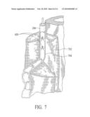 Endovenous Closure of Varicose Veins with Mid Infrared Laser diagram and image