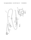 Efficient Controlled Cryogenic Fluid Delivery Into a Balloon Catheter and Other Treatment Devices diagram and image