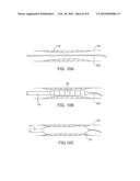 Efficient Controlled Cryogenic Fluid Delivery Into a Balloon Catheter and Other Treatment Devices diagram and image