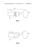 Surgical Gas Plasma Ignition Apparatus and Method diagram and image