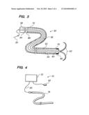 SYSTEMS AND METHODS FOR CREATING A LESION USING TRANSJUGULAR APPROACH diagram and image