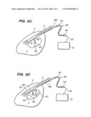 SYSTEMS AND METHODS FOR CREATING A LESION USING TRANSJUGULAR APPROACH diagram and image