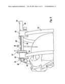 Craniofacial Fracture Reduction Assembly diagram and image