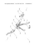 SURGICAL CABLE TENSIONING APPARATUS AND METHOD diagram and image