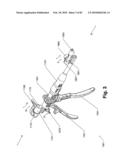 SURGICAL CABLE TENSIONING APPARATUS AND METHOD diagram and image