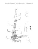 SURGICAL CABLE TENSIONING APPARATUS AND METHOD diagram and image