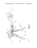 SURGICAL CABLE TENSIONING APPARATUS AND METHOD diagram and image