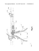 SURGICAL CABLE TENSIONING APPARATUS AND METHOD diagram and image