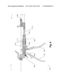 SURGICAL CABLE TENSIONING APPARATUS AND METHOD diagram and image