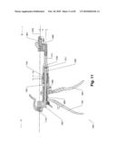 SURGICAL CABLE TENSIONING APPARATUS AND METHOD diagram and image