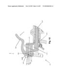 SURGICAL CABLE TENSIONING APPARATUS AND METHOD diagram and image