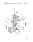 SURGICAL CABLE TENSIONING APPARATUS AND METHOD diagram and image