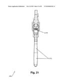 SURGICAL CABLE TENSIONING APPARATUS AND METHOD diagram and image