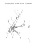 SURGICAL CABLE TENSIONING APPARATUS AND METHOD diagram and image