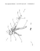 SURGICAL CABLE TENSIONING APPARATUS AND METHOD diagram and image