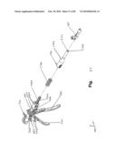 SURGICAL CABLE TENSIONING APPARATUS AND METHOD diagram and image