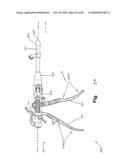 SURGICAL CABLE TENSIONING APPARATUS AND METHOD diagram and image